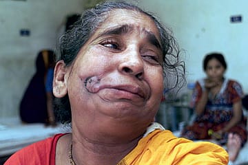 The Agony and the Idiocy