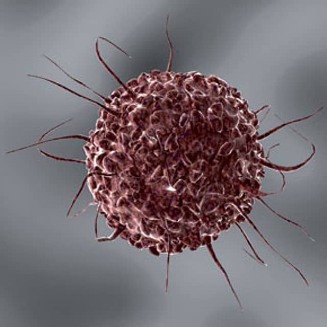 Interpretations of a Malady