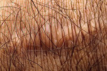 Question of Identity