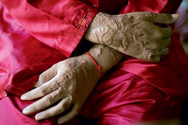 ‘If You Don’t Like My Face, Don’t look’