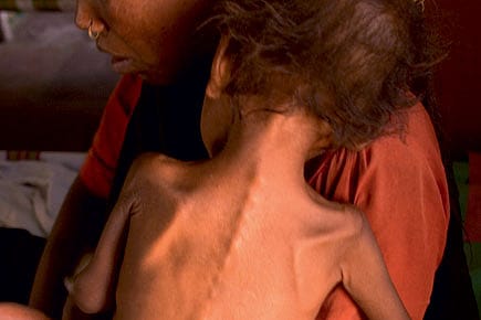 The Underfed and the Unscrupulous