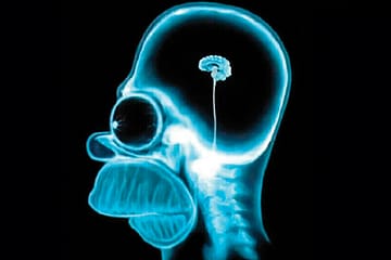 Why Human Brains Are Shrinking