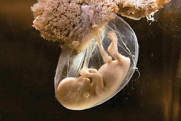 The First Few Hours of Life