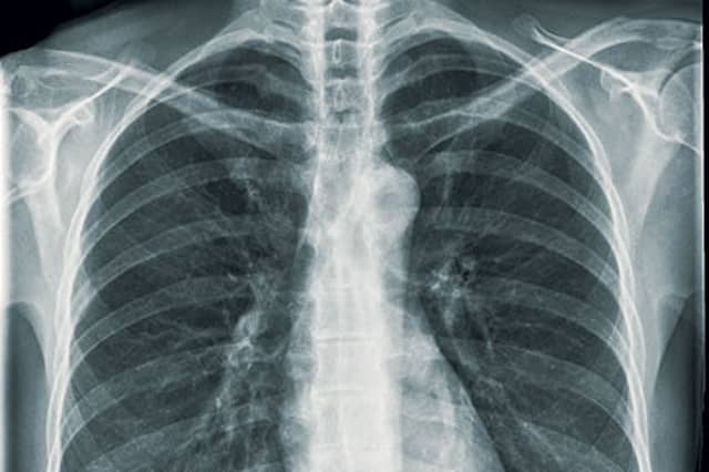 How TB Tricks the Body