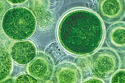 Algae will Save the Day