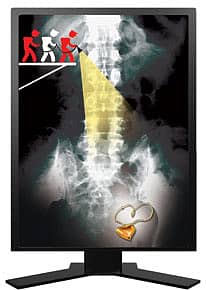 The Gold Thief’s Banana Diet