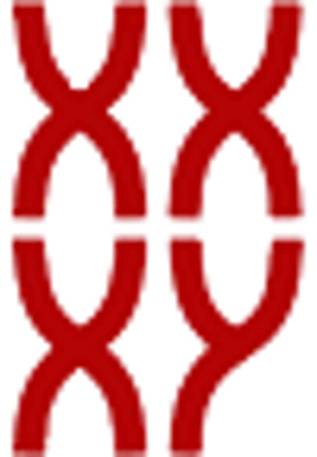 Why Girls Holded Bunny