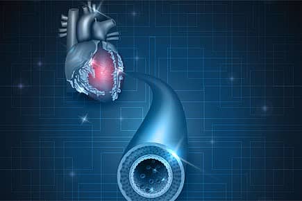 3D Print Your Heart
