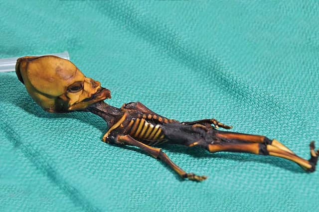 What We Owe to a Girl Called Ata