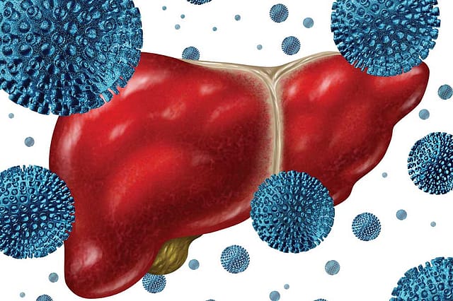 Hepatitis B and C: A Bigger Killer