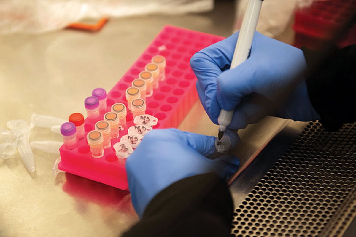 Less Lab Testing ‘The number of tests conducted so far is too low’