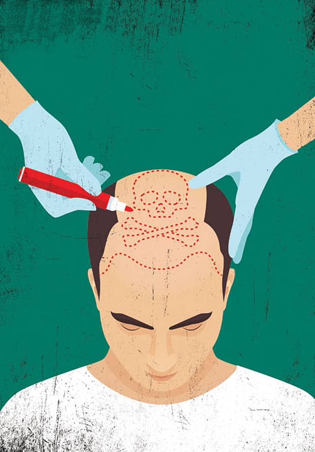 Hair Raising