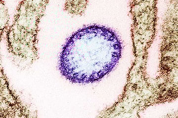 Nipah Explained: Deadly Virus, No Cure, and Rising Concerns in India