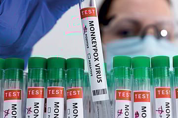 Mpox: The Anxiety Virus